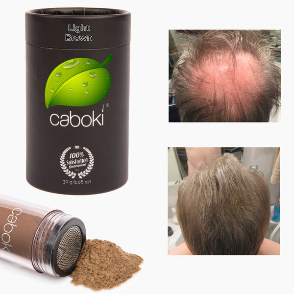 Caboki 30 Gram (90-day supply) **BEST SELLER**