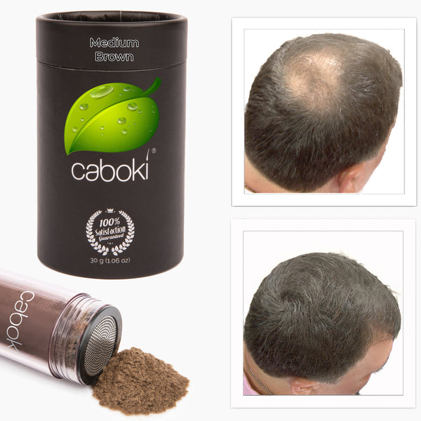 Caboki 30 Gram (90-day supply) **BEST SELLER**